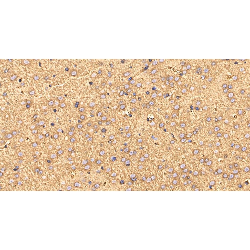 GRP78 BiP抗体 (YA5433),GRP78 BiP Antibody (YA5433)