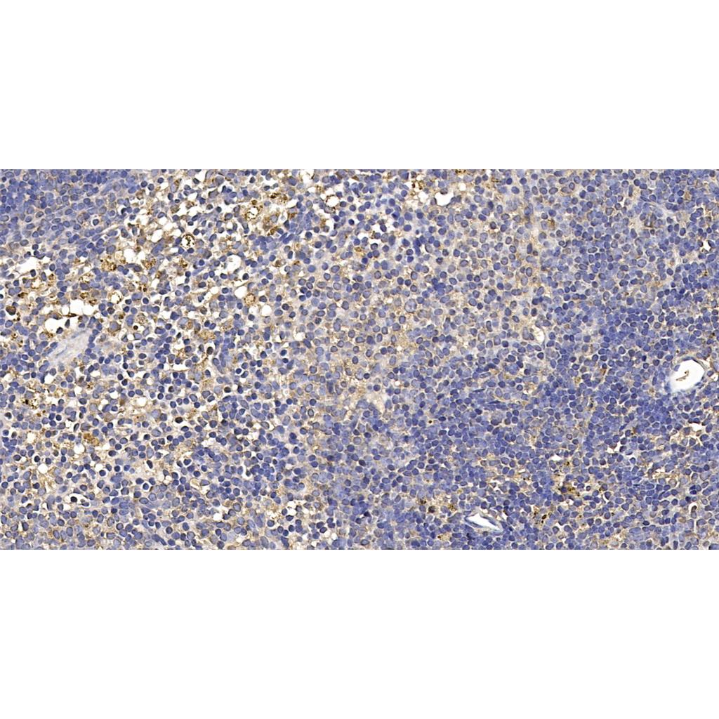 MPO抗体 (YA5574),MPO Antibody (YA5574)