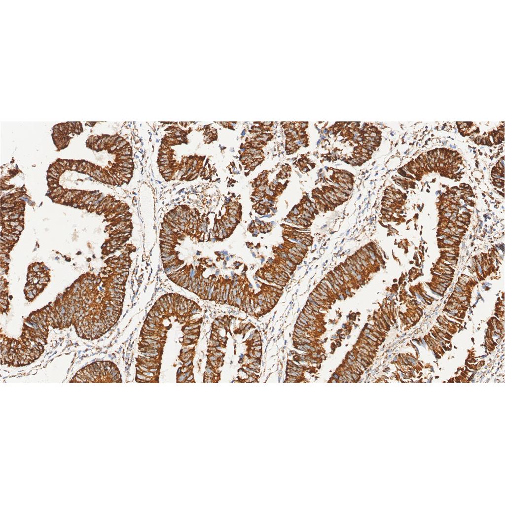 Phospho-CaMKIIβ/γ/δ抗体 (YA5758),Phospho-CaMKIIβ/γ/δ Antibody (YA5758)