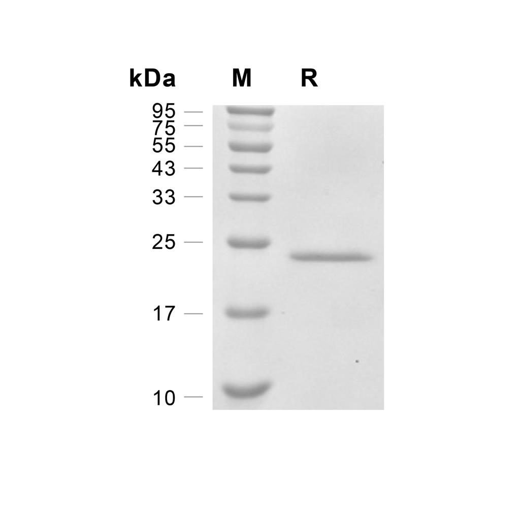 IL-6蛋白, Mouse,IL-6 Protein, Mouse