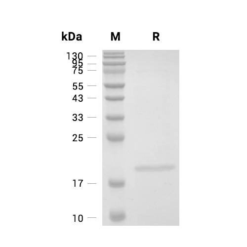Adiponectin/Acrp30蛋白, Human (HEK293),Adiponectin/Acrp30 Protein, Human (HEK293)