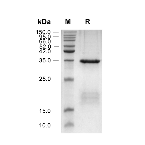 IGFBP-2蛋白, Human (HEK293, His),IGFBP-2 Protein, Human (HEK293, His)