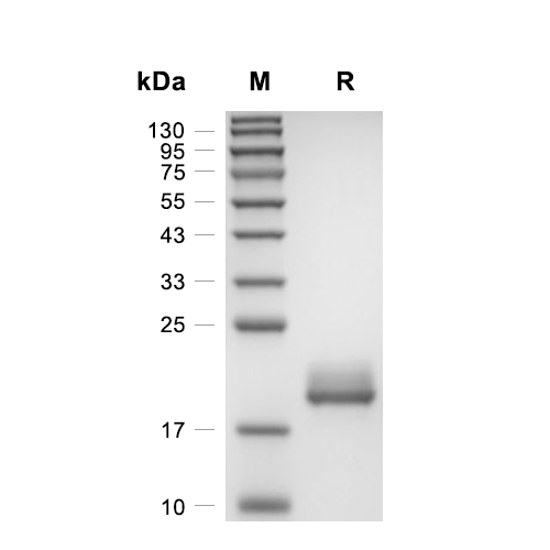 IL-4蛋白, Human (CHO),IL-4 Protein, Human (CHO)