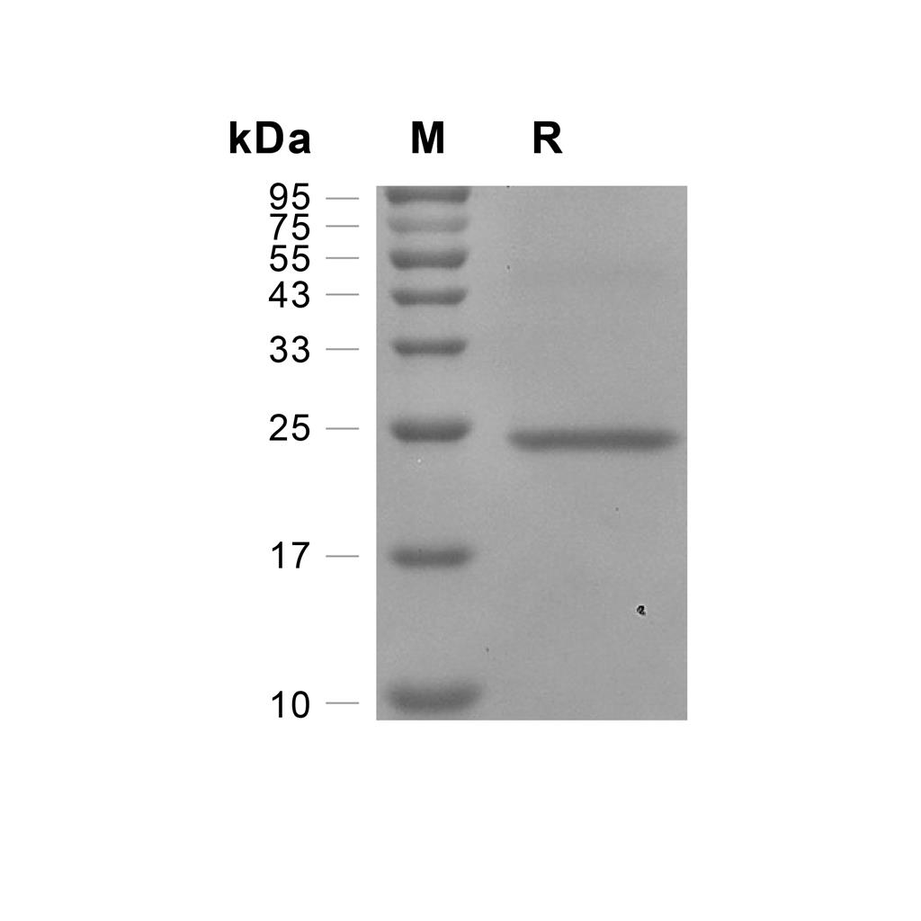 CNTF蛋白, Human,CNTF Protein, Human