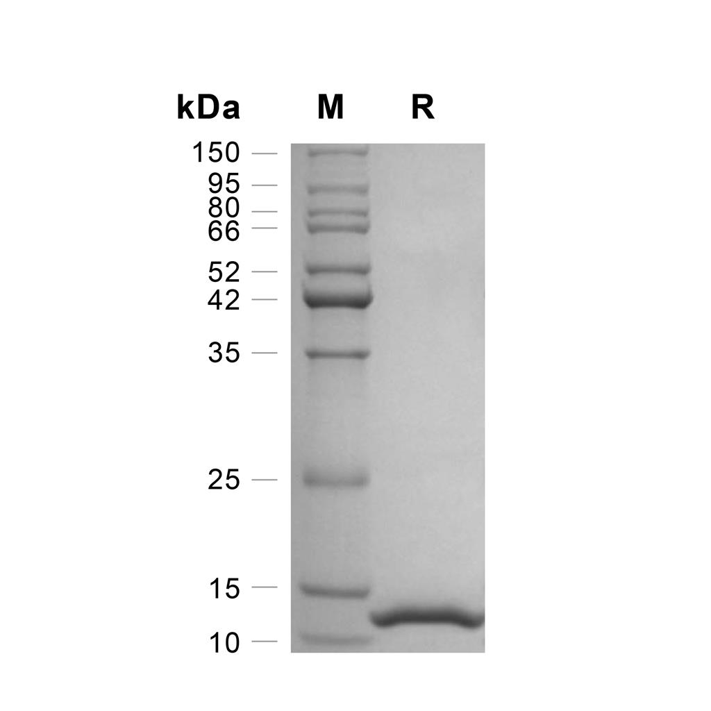 MIF蛋白, Human,MIF Protein, Human