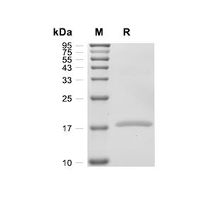 IL-1 beta蛋白, Rat,IL-1 beta Protein, Rat