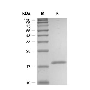 IL-1 beta蛋白, Mouse (CHO)