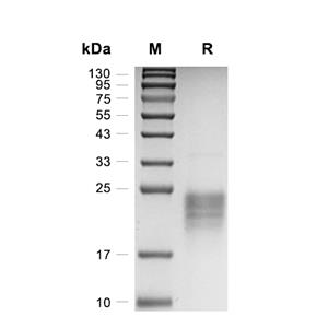 VEGF164蛋白, Rat (CHO)
