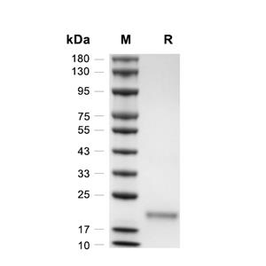 VEGF164蛋白, Mouse,VEGF164 Protein, Mouse