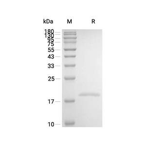 BAFF/TNFSF13B蛋白, Human (CHO)