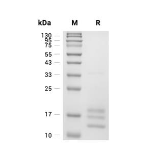 IL-5蛋白, Human (CHO),IL-5 Protein, Human (CHO)