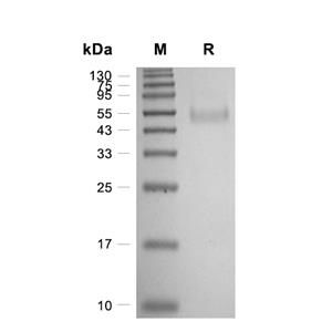 NGFR蛋白, Human (HEK293)
