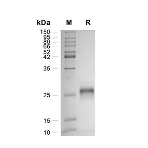 Ephrin-A1/EFNA1蛋白, Human (AAH32698.1, HEK293, His)