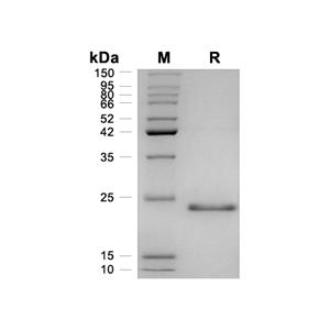 FGF-21蛋白, Human (CHO, His)