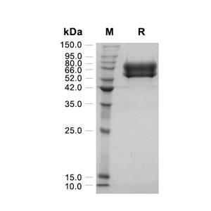IL-2R alpha/CD25蛋白, Human (HEK293, Fc)