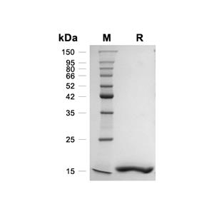Chemerin/RARRES2蛋白, Human (HEK293, His)