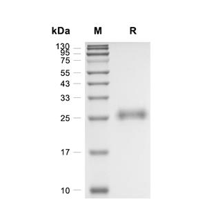 KGF/FGF-7蛋白, Human (CHO)