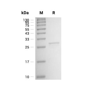Adiponectin/Acrp30蛋白, Mouse (227a.a)