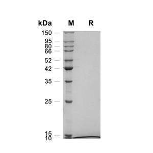 IL-8/CXCL8蛋白, Human (CHO)