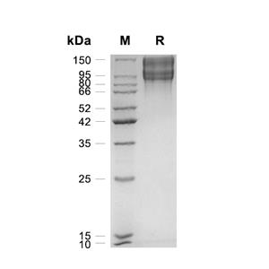 LDLR蛋白, Human (HEK293, His),LDLR Protein, Human (HEK293, His)