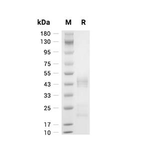 IL-12蛋白, Mouse (CHO),IL-12 Protein, Mouse (CHO)
