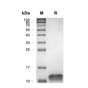 HCC-4/CCL16蛋白, Human (CHO)