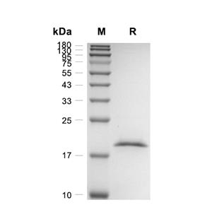 Adiponectin/Acrp30蛋白, Mouse (144a.a)