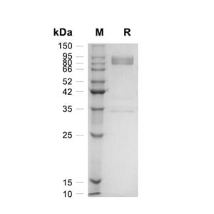 PVR/CD155蛋白, Human (HEK293, Fc)