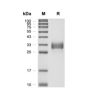 Adiponectin/Acrp30蛋白, Mouse (HEK293, His)