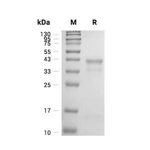 Cathepsin S蛋白, Mouse (HEK293, His)