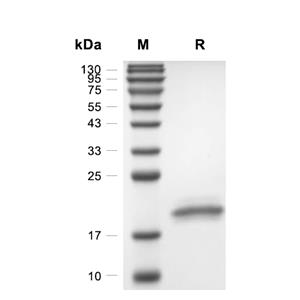 AG-2蛋白, Human (HEK293, His, solution)