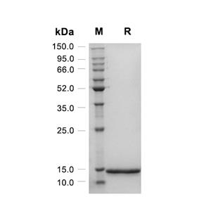 HCC-4/CCL16蛋白, Human