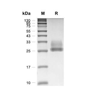 CTRL-1蛋白, Human (HEK293, His)