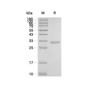 Ketohexokinase/KHK蛋白, Human (HEK293, His)