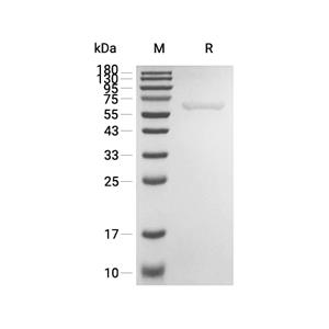 Carboxylesterase 1蛋白, Human (HEK293, His)