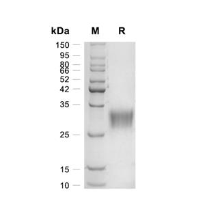 Fibrillin-1/Asprosin蛋白, Mouse (HEK293, His)