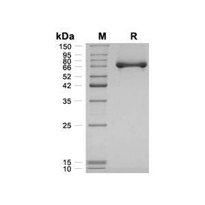 Alpha-Fetoprotein蛋白, Mouse (HEK293, His)