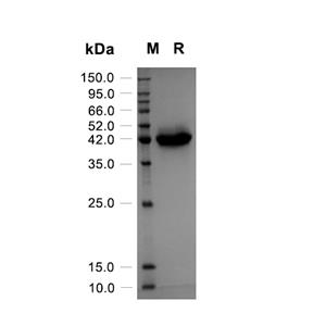 Chitinase-like蛋白 3/YM1蛋白, Mouse (HEK293, His)