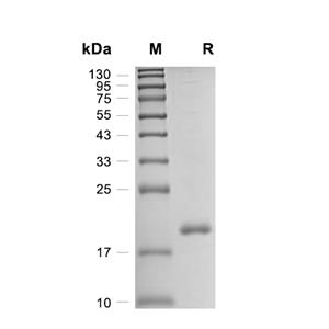 Calmodulin蛋白, Human