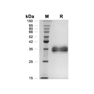 EpCAM/TROP1蛋白, Human (HEK293, His)