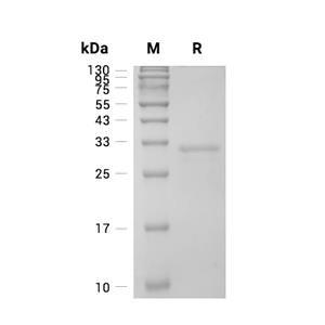 HABP1/C1QBP蛋白, Human (His)