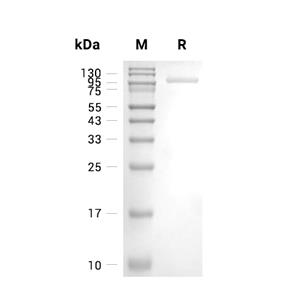 Complement Factor B/CFB蛋白, Human (HEK293, His),Complement Factor B/CFB Protein, Human (HEK293, His)