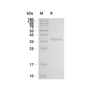 Apolipoprotein E/APOE蛋白, Mouse (HEK293, His)