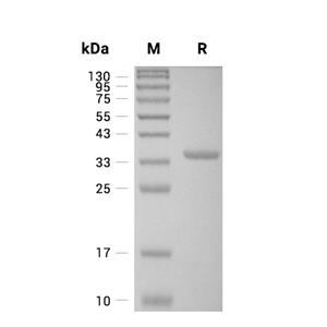 Arginase-2/ARG2蛋白, Human (His)