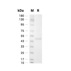 ASS1蛋白, Human (His)