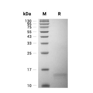 Cytochrome c/CYCS蛋白, Human (His),Cytochrome c/CYCS Protein, Human (His)