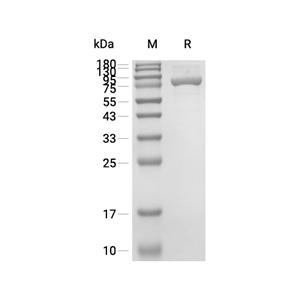 Dipeptidyl peptidase 3/DPP3蛋白, Human (His)