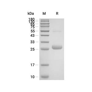Acyl-protein thioesterase 2/LYPLA2蛋白, Human (His)