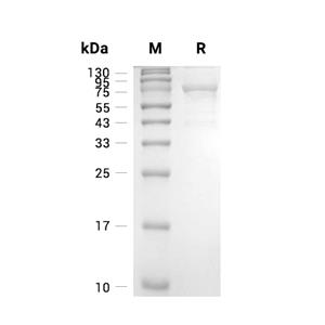 Aminopeptidase P1蛋白, Human (His)