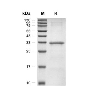 CD105/Endoglin蛋白, Human (Trx-His)